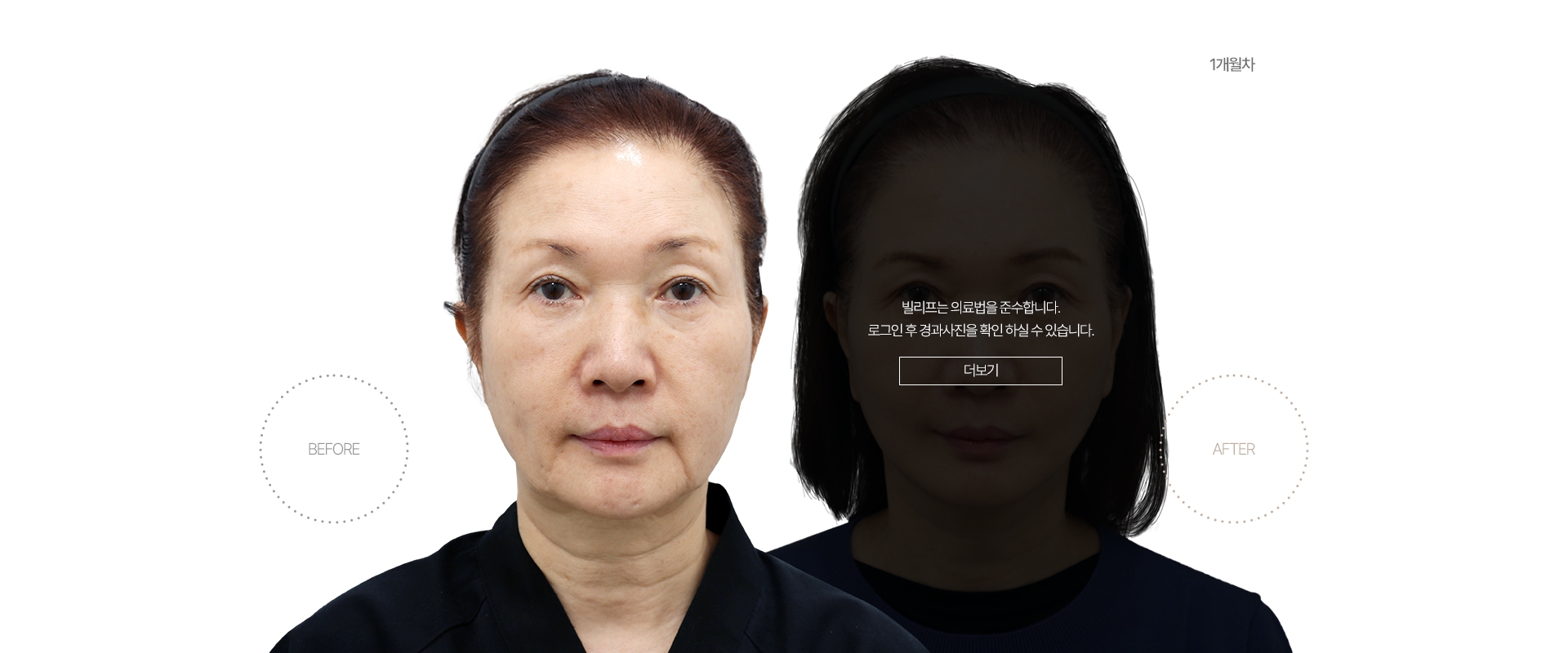 5개월차 BEFORE - AFTER