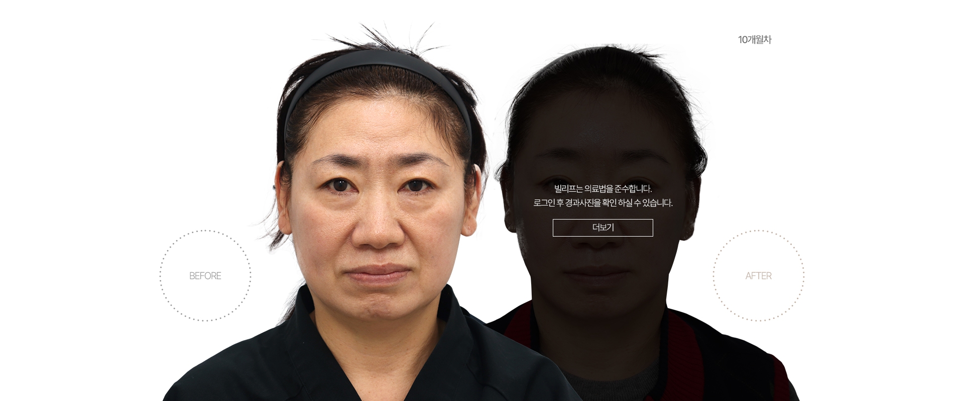 5개월차 BEFORE - AFTER