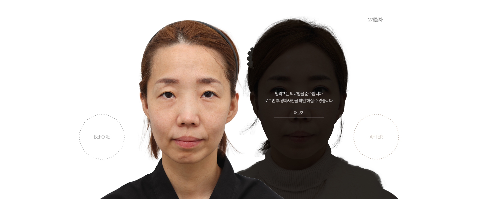 5개월차 BEFORE - AFTER