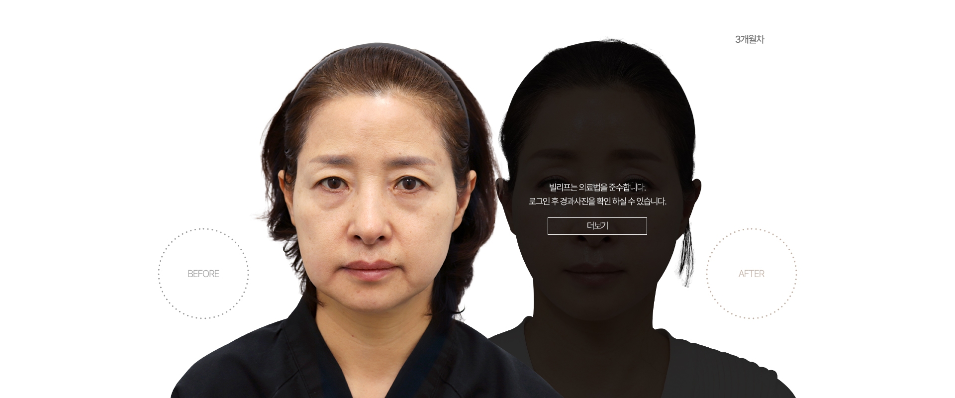 5개월차 BEFORE - AFTER