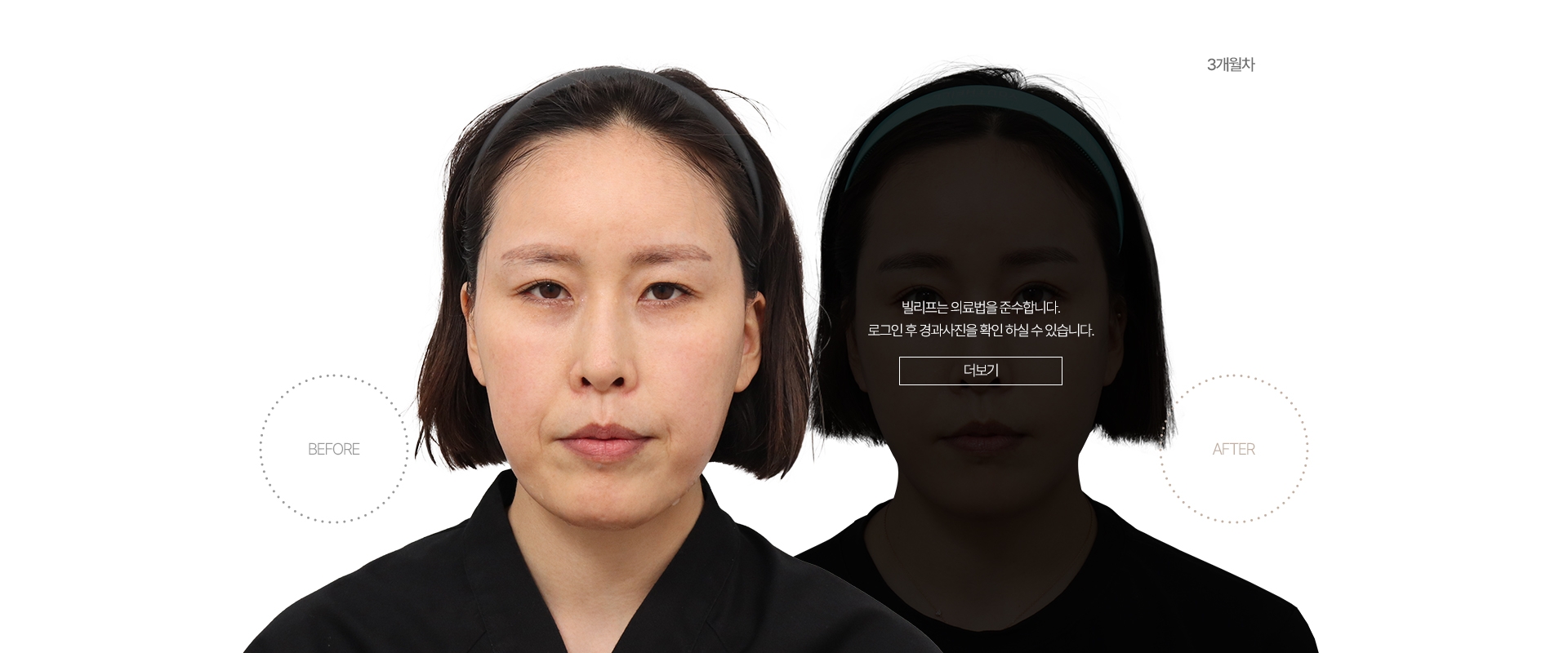 5개월차 BEFORE - AFTER