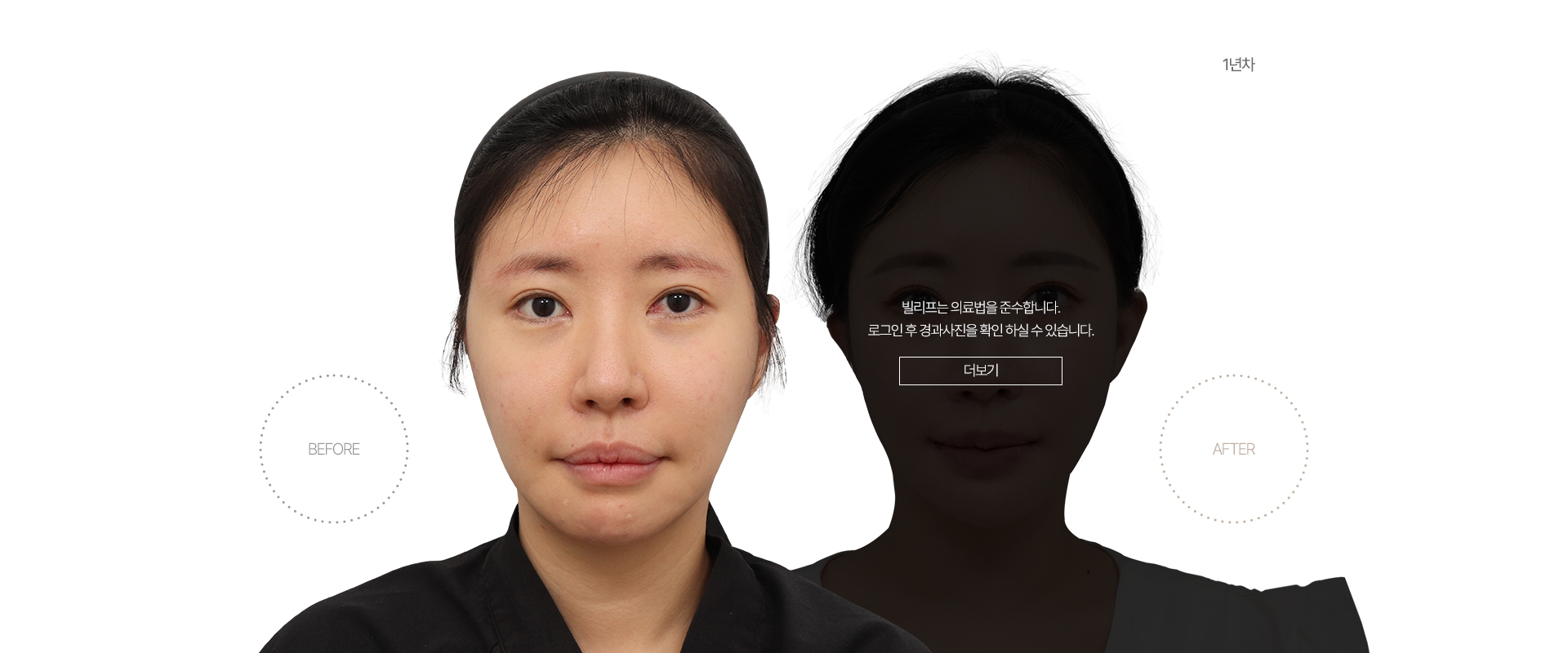 5개월차 BEFORE - AFTER