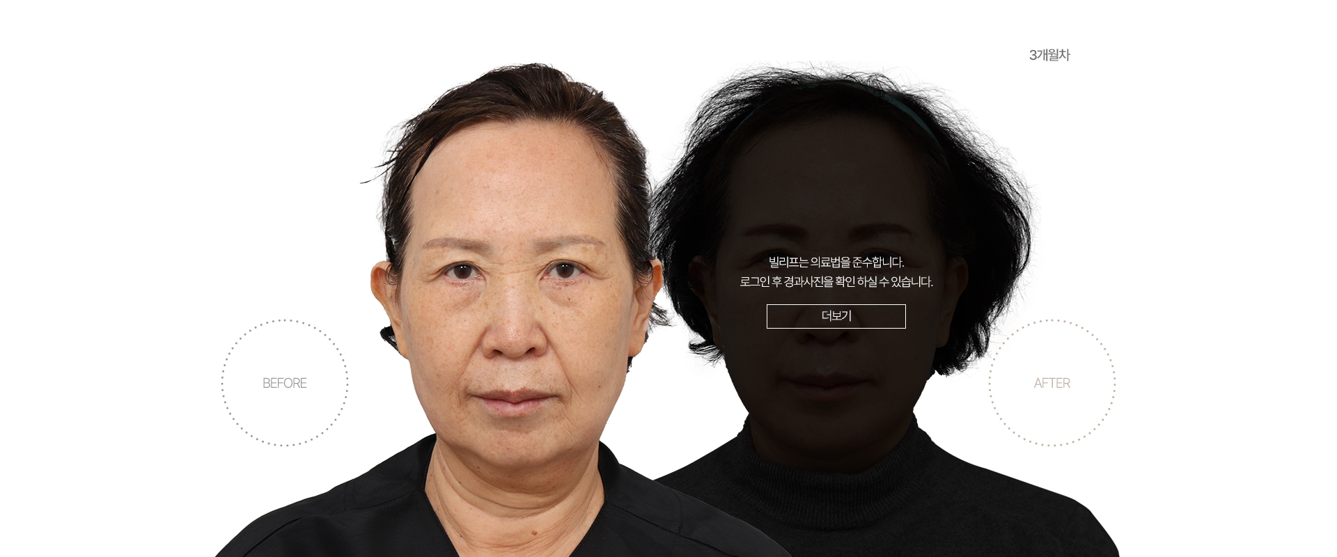 5개월차 BEFORE - AFTER