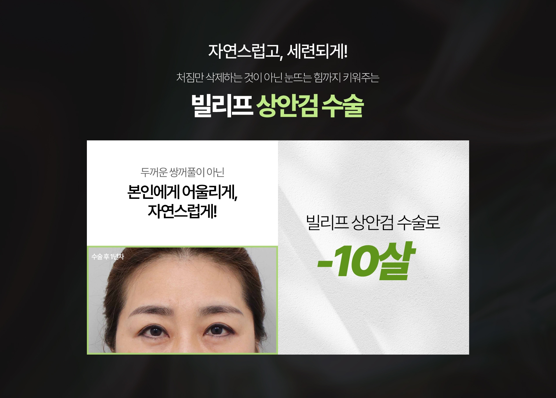 자연스럽고, 세련되게! 처짐만 삭제하는 것이 아닌 눈뜨는 힘까지 키워주는 빌리프 상안검 수술 두꺼운 쌍꺼풀이 아닌 본인에게 어울리게, 자연스럽게! 빌리프 상안검 수술로 -10살