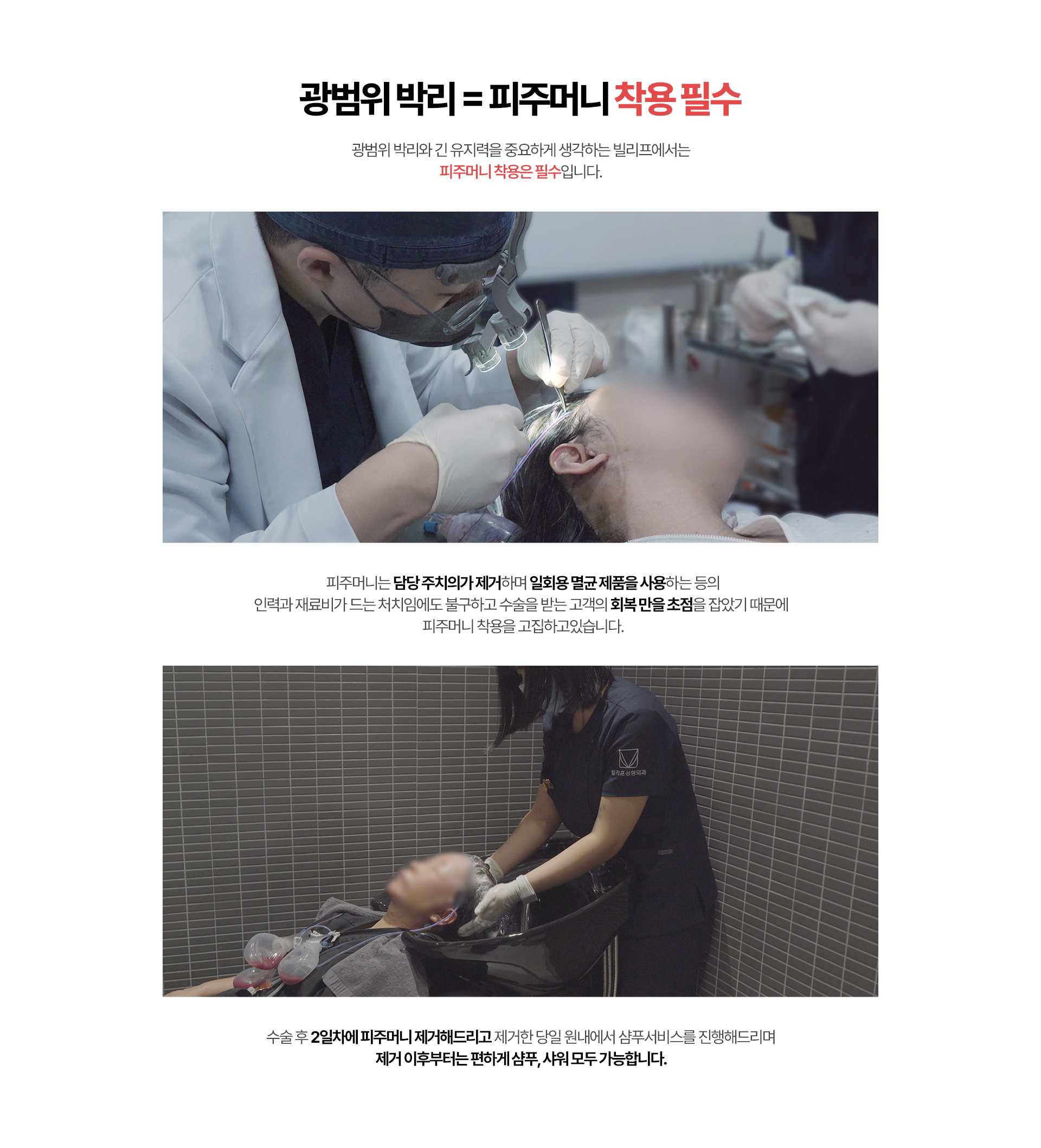 광범위 박리 = 피주머니 착용 필수 광범위 박리와 긴 유지력을 중요하게 생각하는 빌리프에서는 피주머니 착용은 필수입니다.피주머니는 담당 주치의가 제거하며 일회용 멸균 제품을 사용하는 등의 인력과 재료비가 드는 처치임에도 불구하고 수술을 받는 고객의 회복 만을 초점을 잡았기 때문에 피주머니 착용을 고집하고있습니다.수술 후 2일차에 피주머니 제거해드리고 제거한 당일 원내에서 샴푸서비스를 진행해드리며 제거 이후부터는 편하게 샴푸, 샤워 모두 가능합니다.