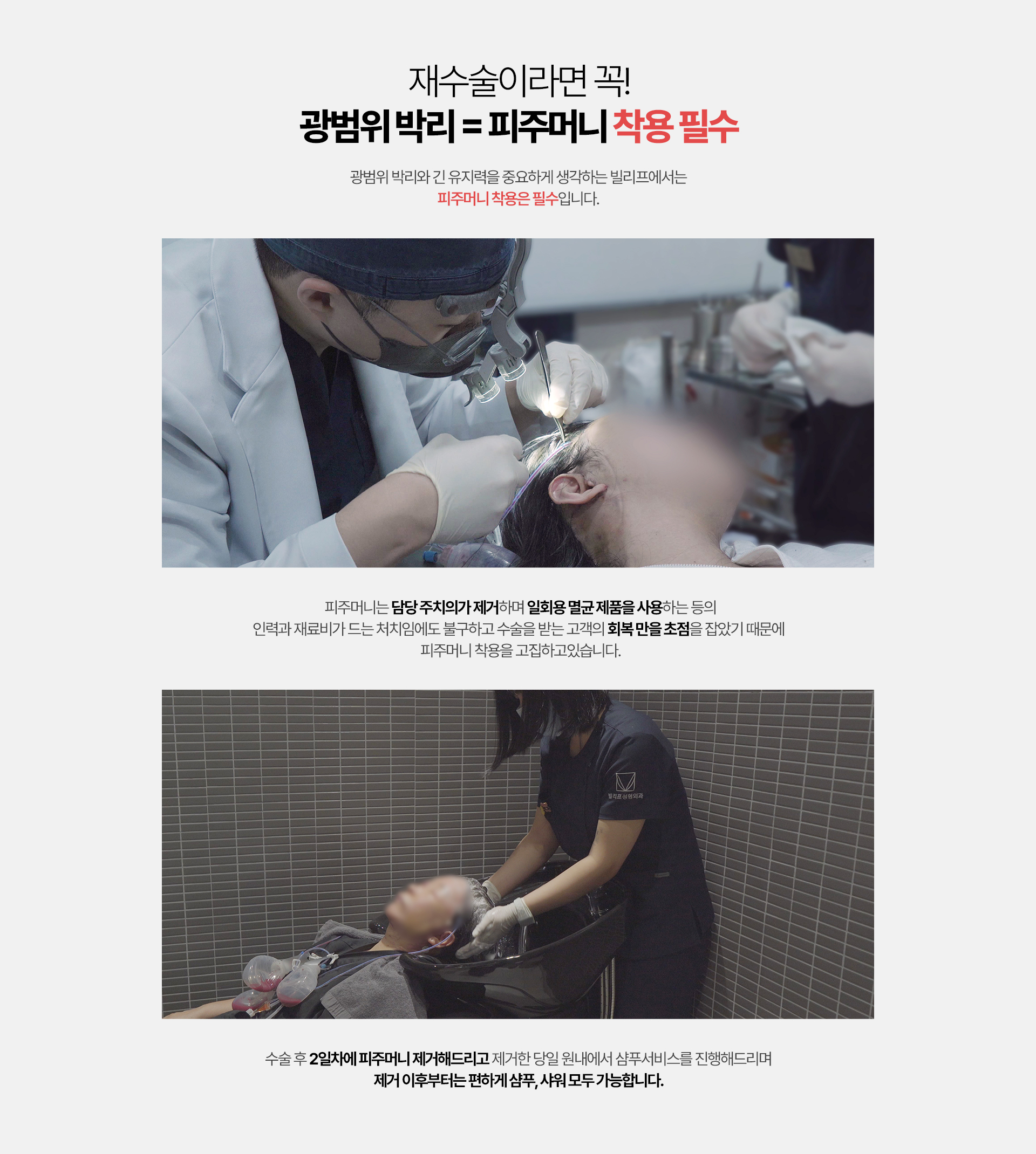 재수술이라면 꼭! 광범위 박리 = 피주머니 착용 필수 광범위 박리와 긴 유지력을 중요하게 생각하는 빌리프에서는 피주머니 착용은 필수 입니다. 피주머니는 담당 주치의가 제거하며 일회용 멸균 제품을 사용하는 등의 인력과 재료비가 드는 처치임에도 불구하고 수술을 받는 고객의 회복 만을 초점을 잡았기 떄문에 피주머니 착용을 고집하고 있습니다. 수술 후 2일차네 피주머니 제거해드리고 제거한 당일 원내에서 샴푸서비스를 진행해드리며 제거 이후부터는 편하게 샴푸, 샤워 모두 가능합니다.