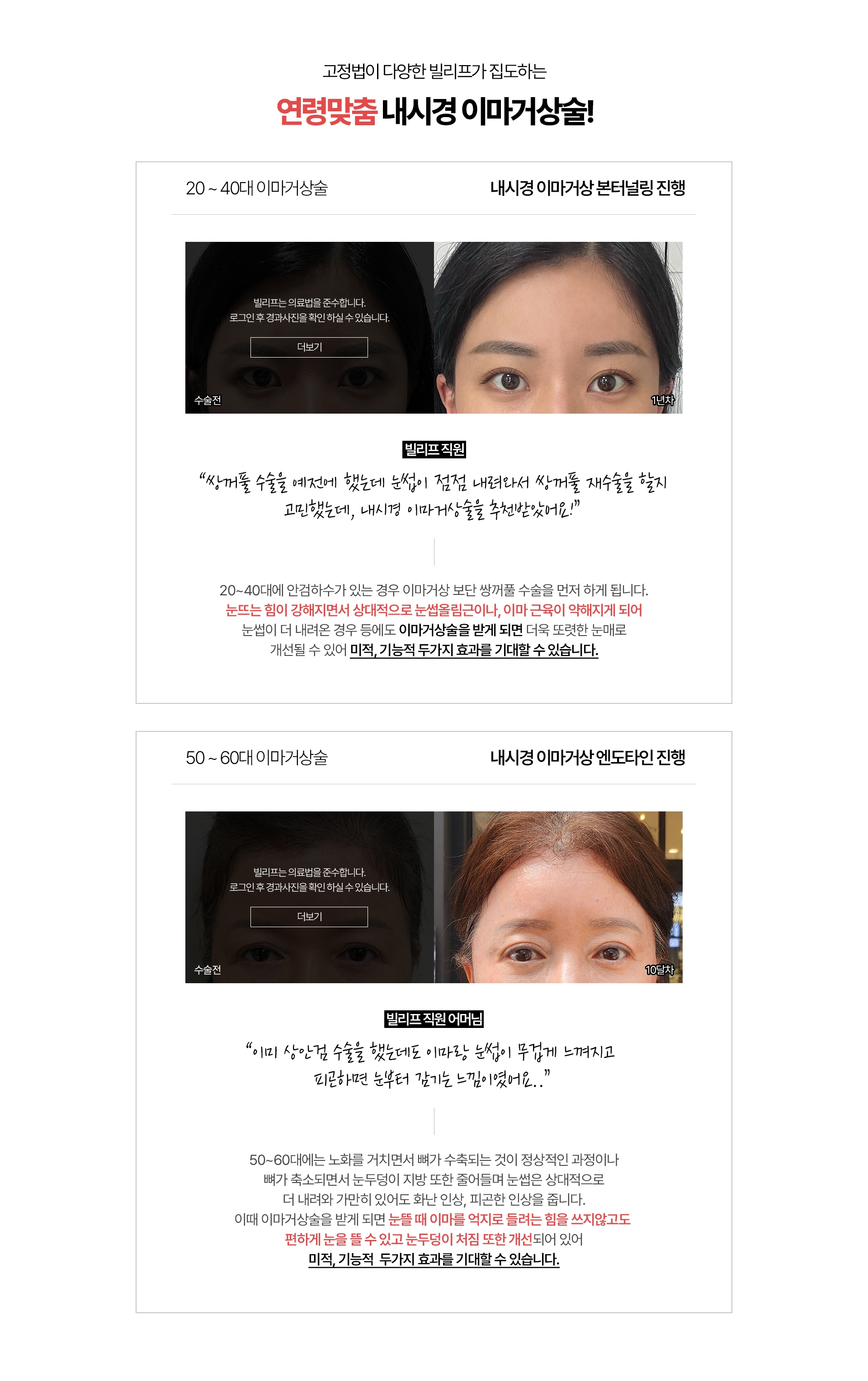 고정법이 다양한 빌리프가 집도하는 연령맞춤 내시경 이마거상술! 20~40 이마거상술 (내시경 이마거상 본터널링 진행 ) *빌리프 직원 쌍꺼풀 수술을 예전에 했는데 눈썹이 점점 내려와서 쌍꺼풀 재수술을 할지 고민했는데 내시경 이마거상술을 추천받았어요 20~40대에 안검하수가 있는 경우 이마거상 보단 쌍꺼풀 수술을 먼저 하게 됩니다. 눈뜨는 힘이 강해지면서 상대적으로 눈썹올림근이나, 이마 근육이 약해지게 되어 눈썹이 더 내려온 경우 등에도 이마거상술을 받게 되면 더욱 또렷한 눈매로 개선될 수 있어 미적, 기능적  두가지 효과를 기대할 수 있습니다. / 50~60 이마거상술 (내시경 이마거상 엔도타인 진행) *빌리프 직원 어머님 이미 상안검 수술을 했는데도 이마랑 눈썹이 무겁게 느껴지고 피곤하면 눈부터 감기는 느낌이였어요.. 50~60대에는 노화를 거치면서 뼈가 수축되는 것이 정상적인 과정이나 뼈가 축소되면서 눈두덩이 지방 또한 줄어들며 눈썹은 상대적으로 더 내려와 가만히 있어도 화난 인상, 피곤한 인상을 줍니다. 이때 이마거상술을 받게 되면  눈뜰 때 이마를 억지로 들려는 힘을 쓰지않고도 편하게 눈을 뜰 수 있고 눈두덩이 처짐 또한 개선되어 있어 미적, 기능적 두가지 효과를 기대할 수 있습니다. 